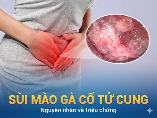 Bệnh sùi mào gà ở cổ tử cung