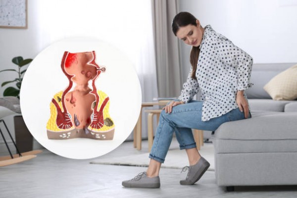 Bị bệnh trĩ khi mang thai có sinh thường được không?