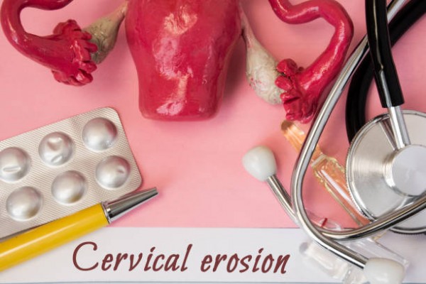 địa chỉ chữa viêm lộ tuyến cổ tử cung ở đâu tốt nhất tại Hà Nội