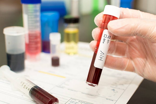 Xét nghiệm HIV ở đâu Hà Nội tốt nhất