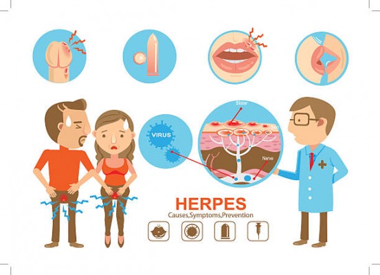 Mụn rộp sinh dục có nguy hiểm không? Cách trị dứt điểm