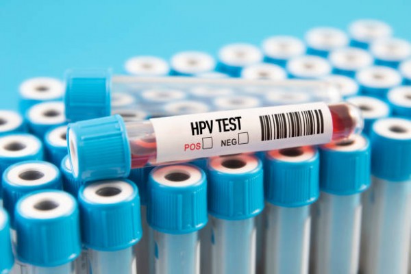 11 địa chỉ xét nghiệm HPV ở đâu tốt nhất tại Hà Nội