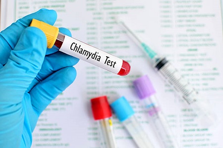 Chi phí xét nghiệm bệnh xã hội bao nhiêu tiề