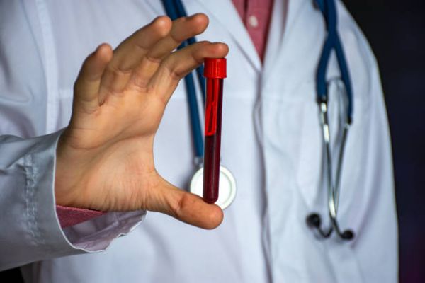 Chi phí xét nghiệm bệnh giang mai hết bao nhiêu tiền