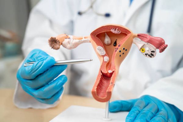 viêm nhiễm phụ khoa ở nữ giới